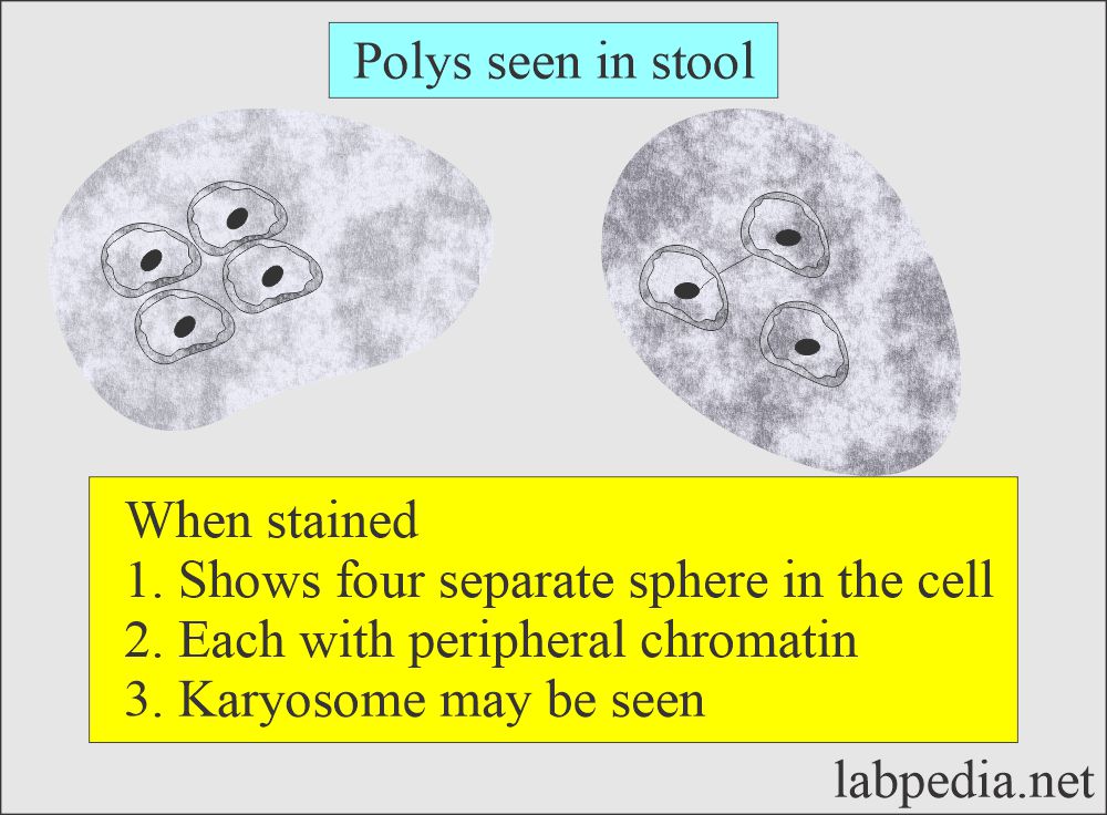 Stool examination: Polys seen in the stool