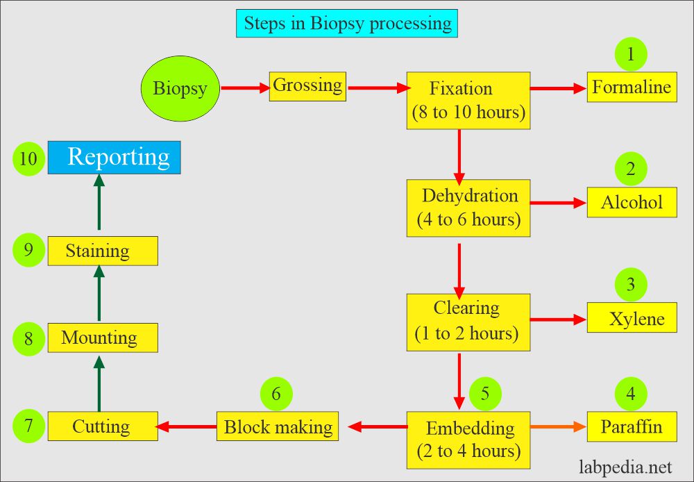 Steps in the process of surgical pathology