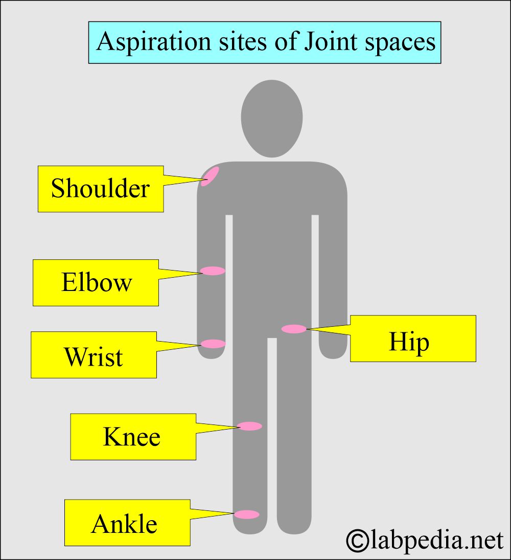 Synovial aspiration sites Synovial aspiration sites