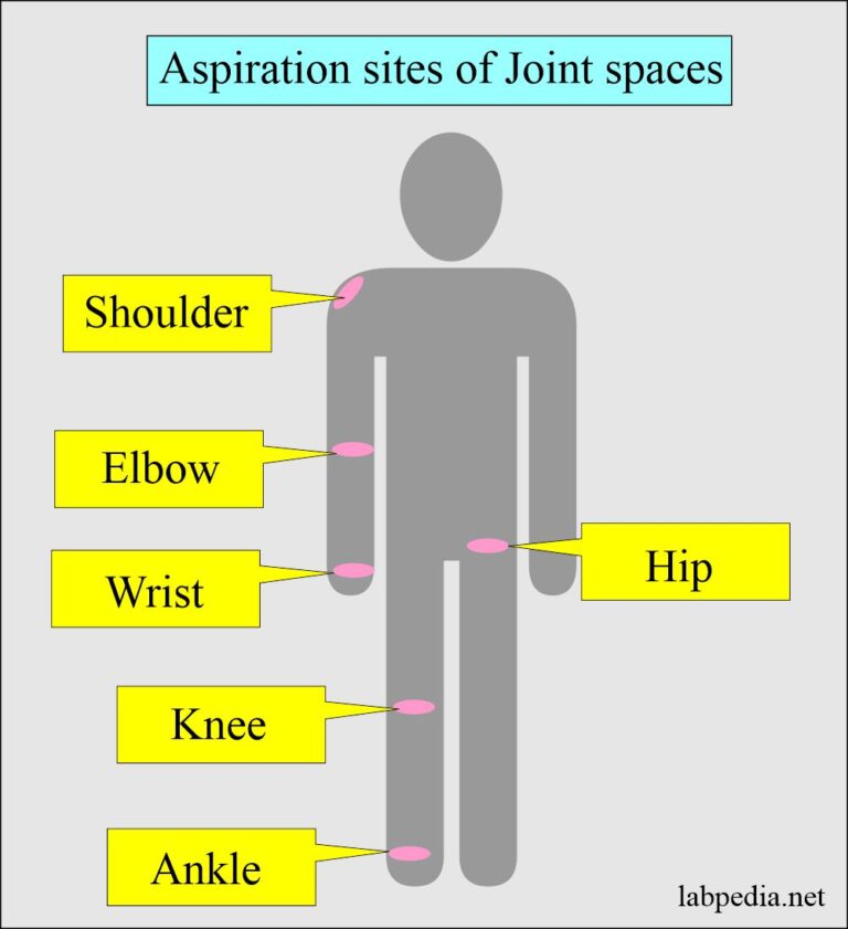 Synovial Fluid Analysis, Procedure for Arthrocentesis