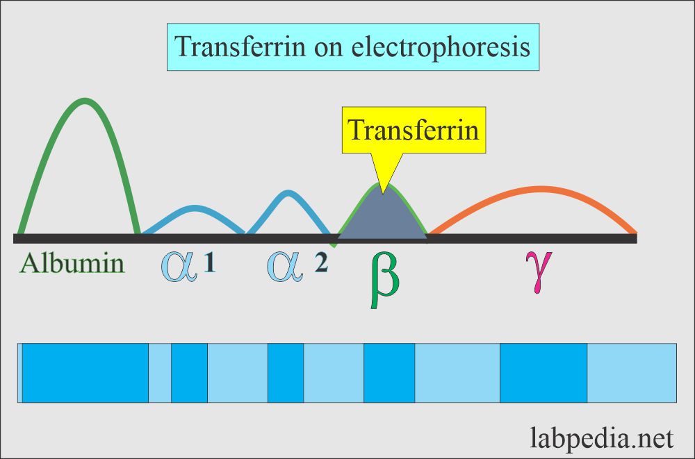 Transferrin on electrophoresis