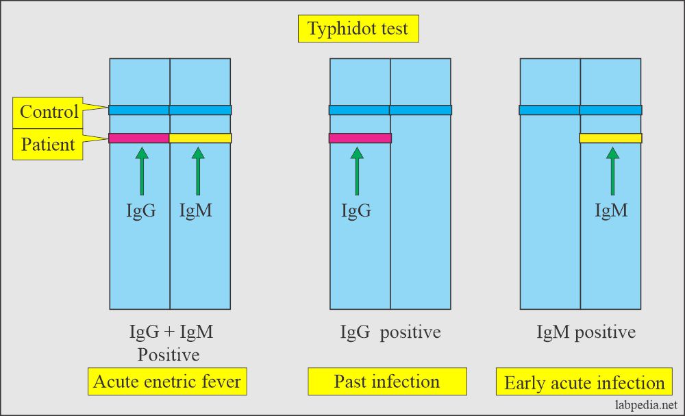 Interpretation of the Typhidot test in enteric fever