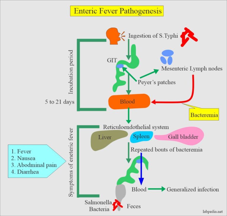 enteric-fever-part-2-typhoid-enteric-fever-diagnosis-widal-test