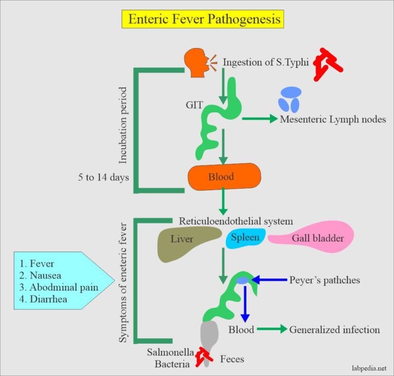 Typhoid Fever, Enteric Fever (Salmonella Typhi)