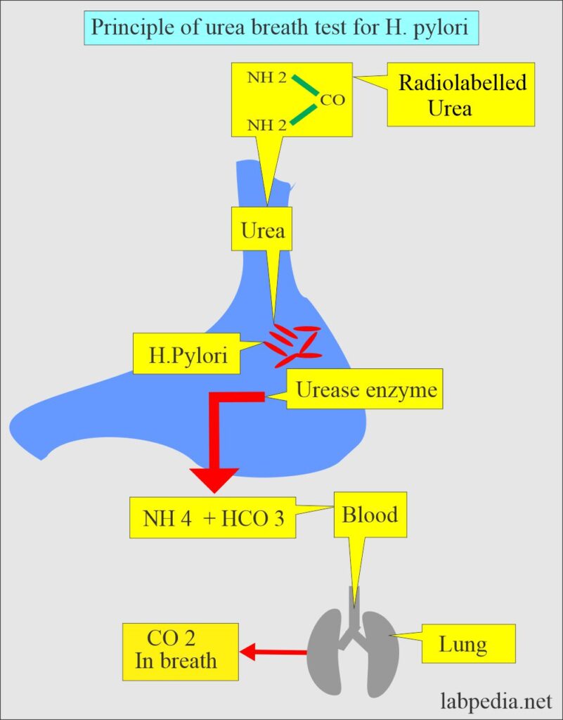 Urea Breath Test For Pylori Helicobacter Pylori Labpedia Net