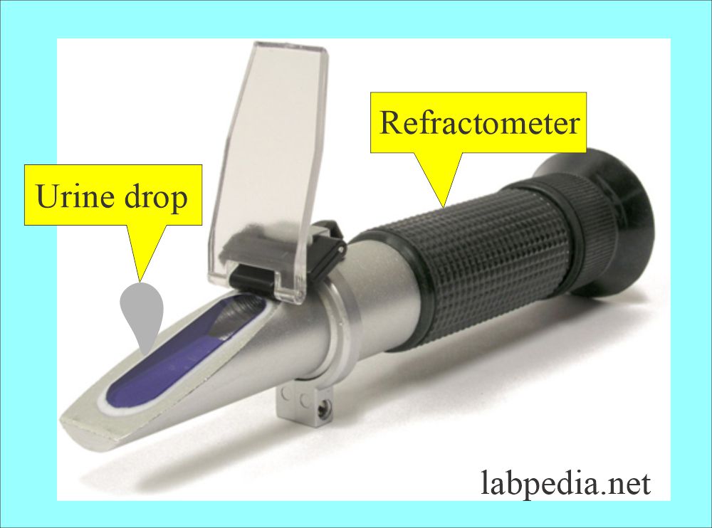 Urine Specific Gravity: Urine refractometer