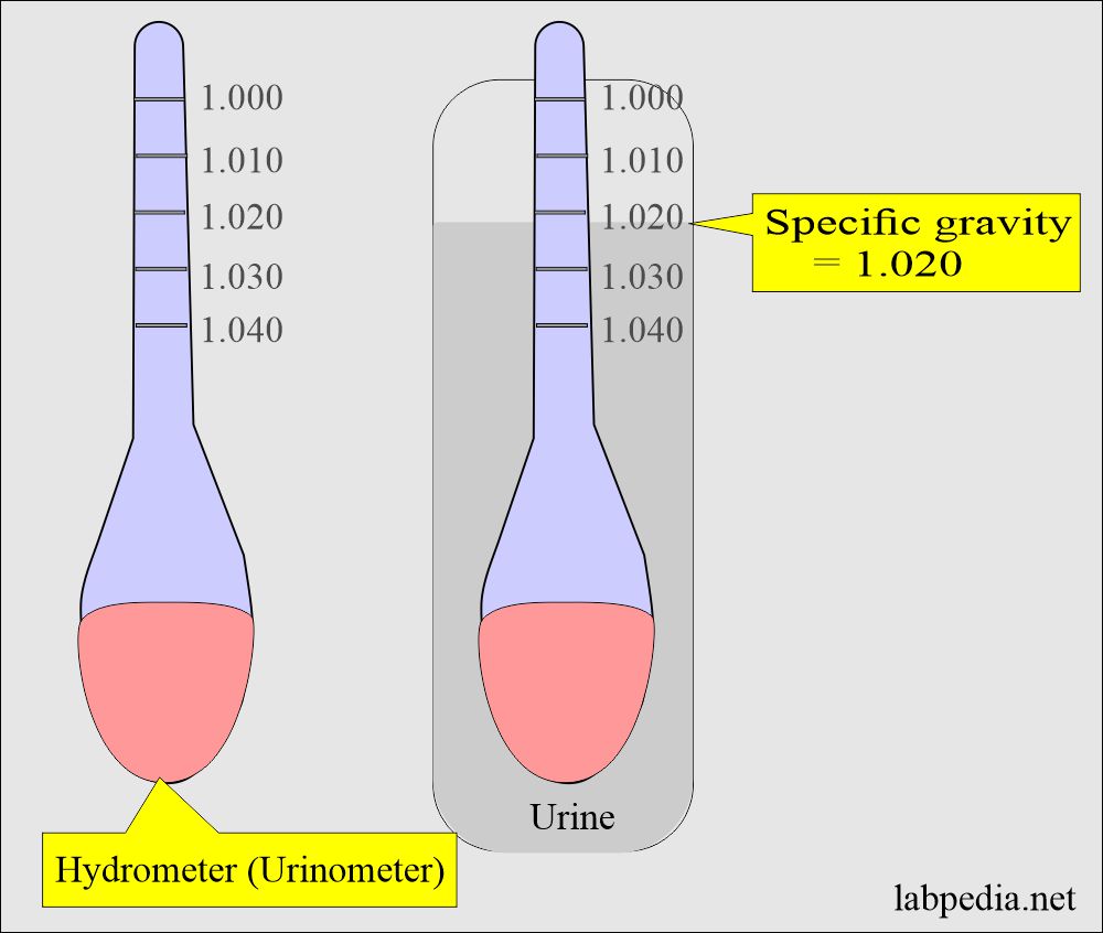 Renal Functions:  Urine specific gravity measurement by urinometer