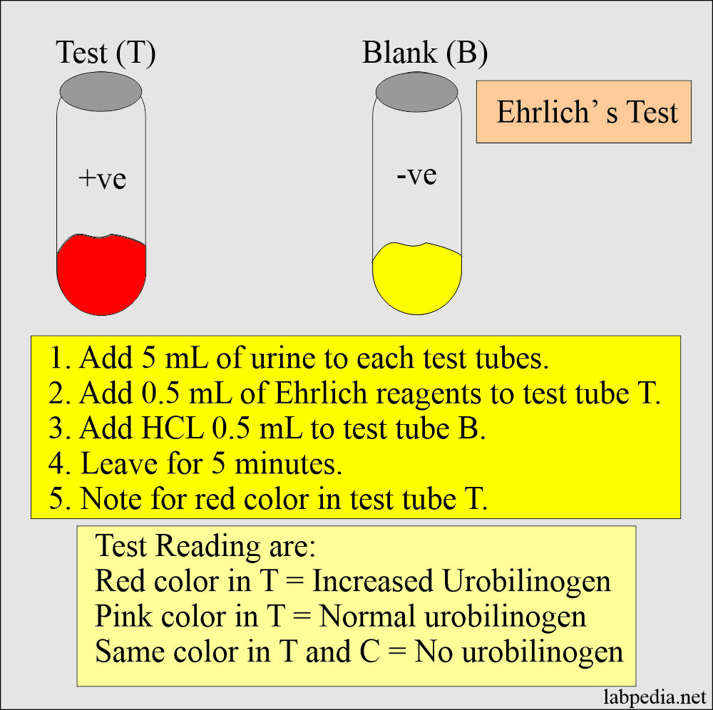 Urine for Urobilinogen