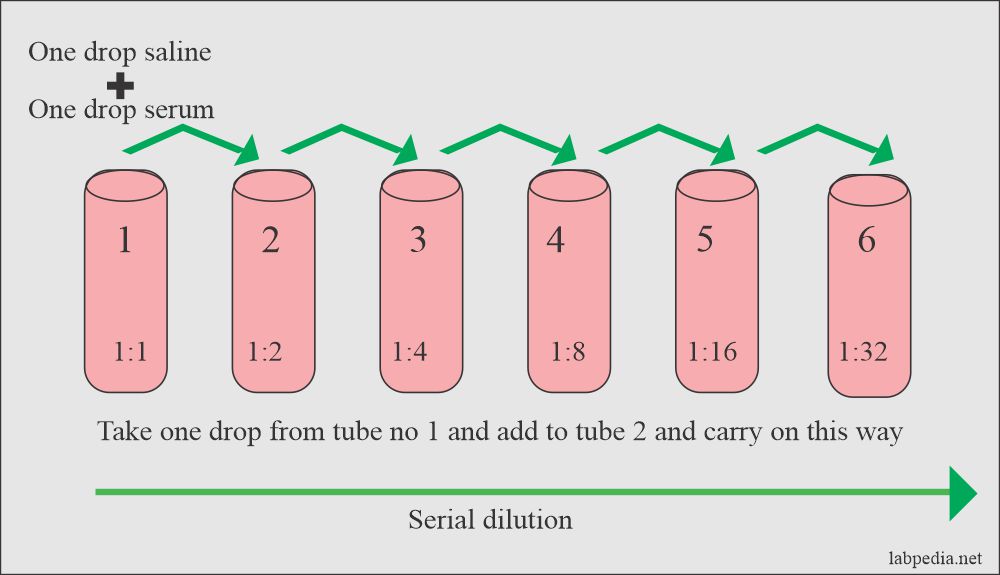 Serial dilution in the widal test