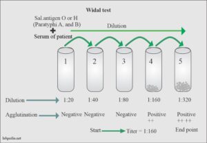 Salmonella Paratyphi, Paratyphoid Fever, Diagnosis And Treatment