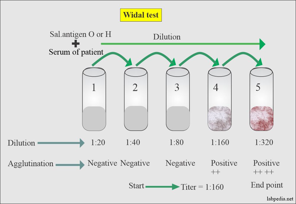 Procedure of the widal test