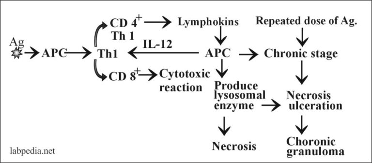 Chapter 14: Hypersensitivity Reaction Type IV, Cell Mediated Delayed ...