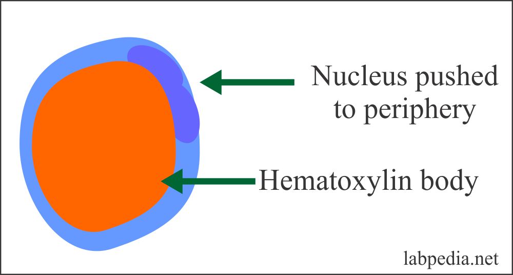 Fig 14: L E Cell Phenomenon