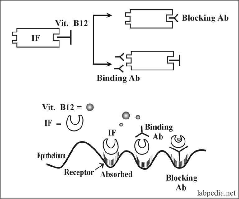 Chapter 22 Autoimmune diseases, Pernicious Anemia (Vitamin B12