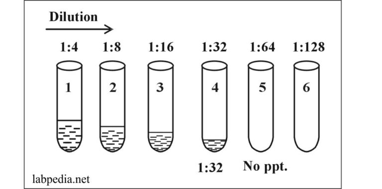 importance of serial dilution in serological tests