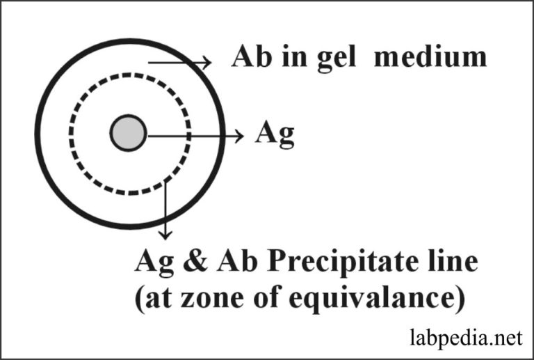 single radial immunodiffusion experiment