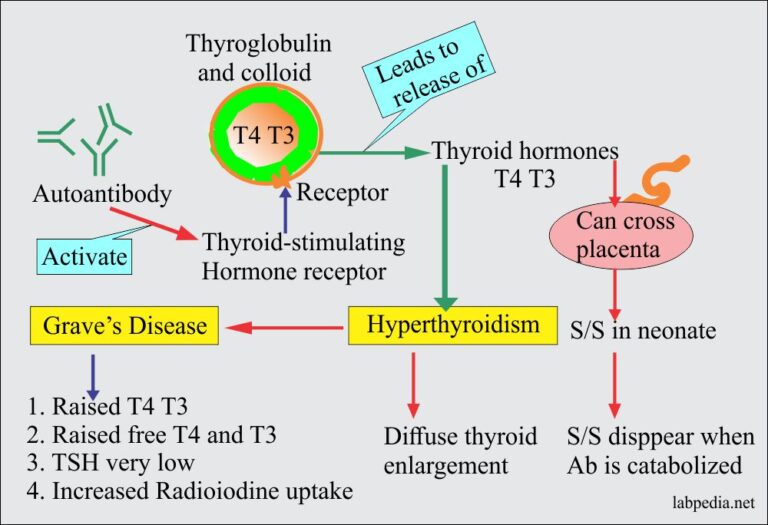 Chapter 23: Autoimmune diseases, Hashimoto's Thyroiditis and Grave's ...