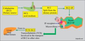 Chapter 22: Autoimmune diseases, Pernicious Anemia (Vitamin B12