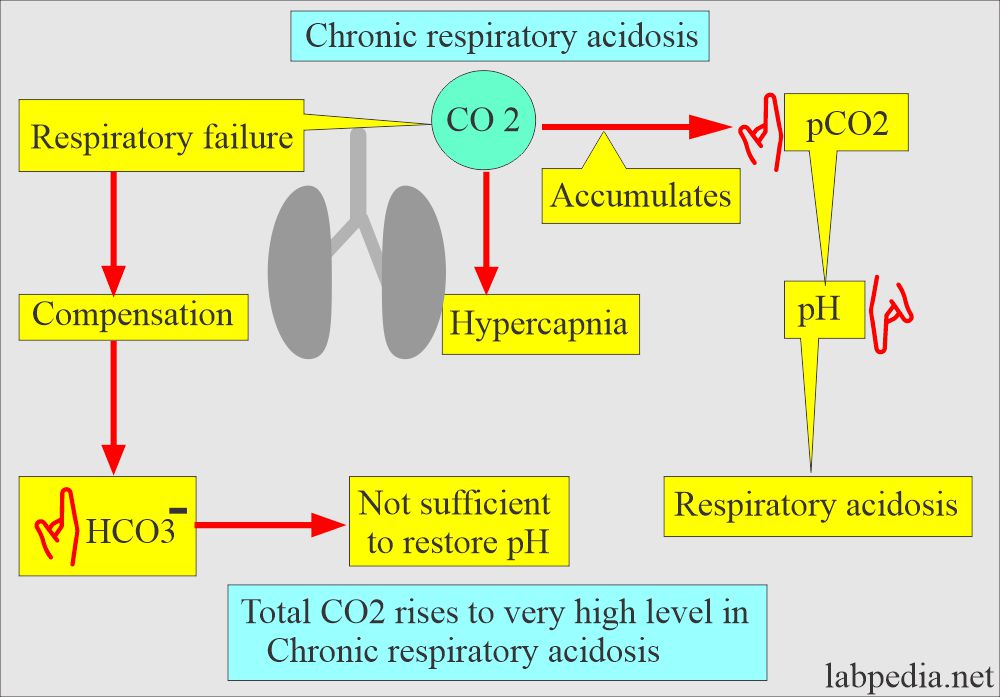 Chronic Respiratory acidosis