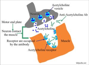 Chapter 12: Type II Hypersensitivity Reaction And ADCC (Cytotoxic ...