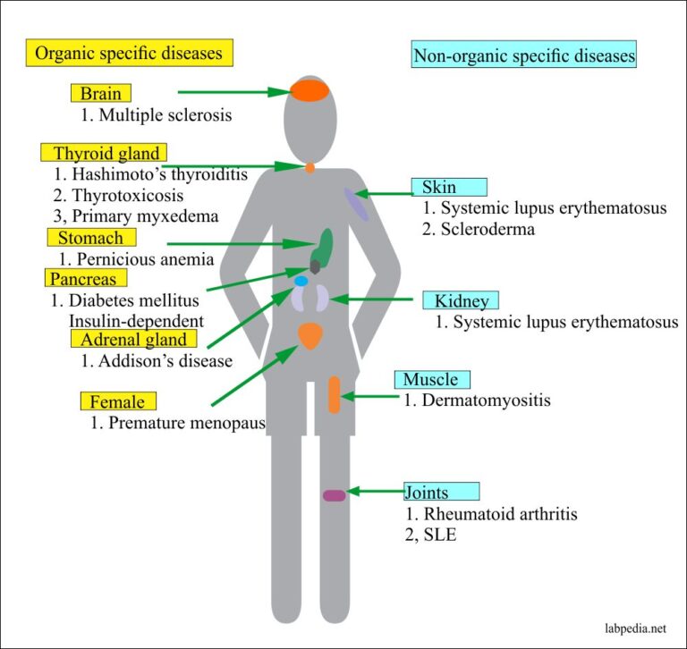 Chapter 16 Autoimmunity Immunologic Tolerance And Mechanism Of