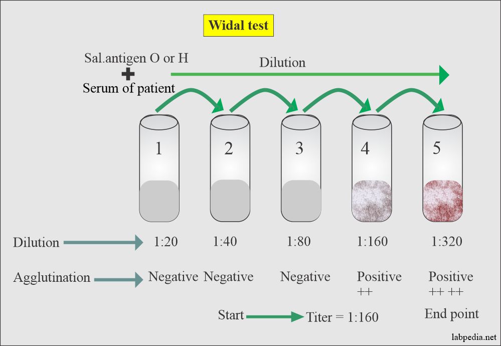 Chapter 32 Common Serological Tests Widal Test Rheumatoid Factor RA 