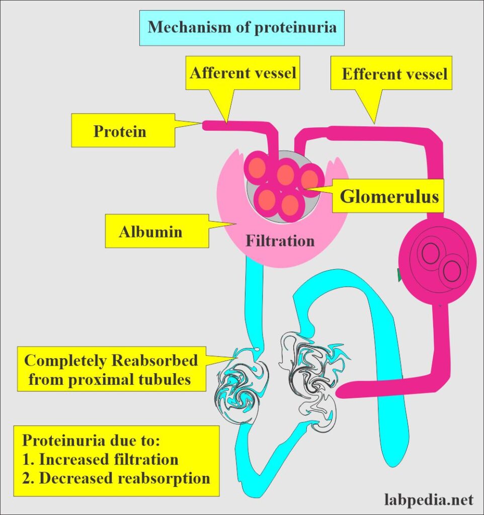 urine-analysis-chemical-examination-and-interpretations-part-4