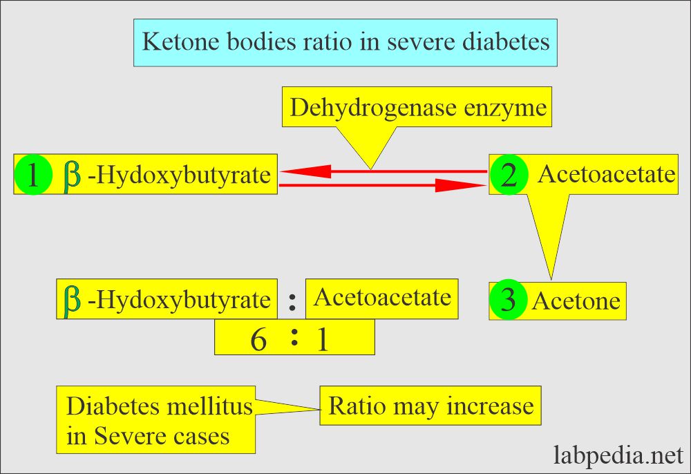 ketone bodies in diabetes mellitus