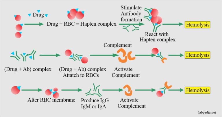 Chapter Autoimmune Diseases Autoimmune Hemolytic Anemia Aha Labpedia Net