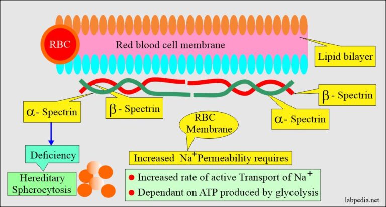 Anemia:- Part 7 - Hereditary Spherocytosis - Labpedia.net