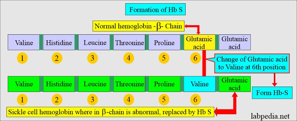 Formation of Hb S in sickle cell anemia