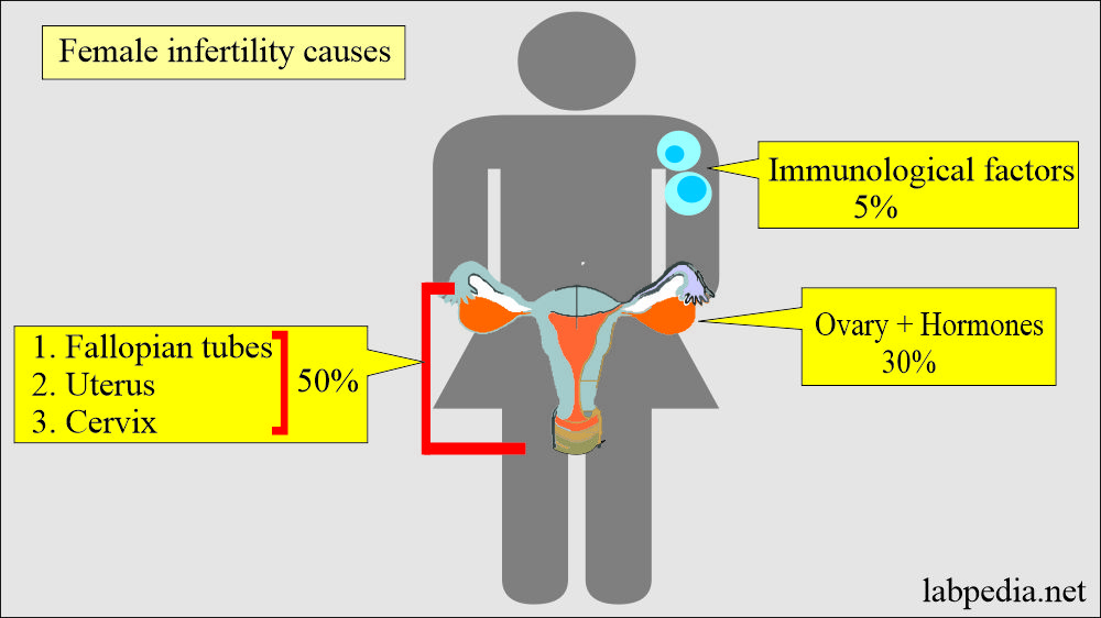 Female infertility causes