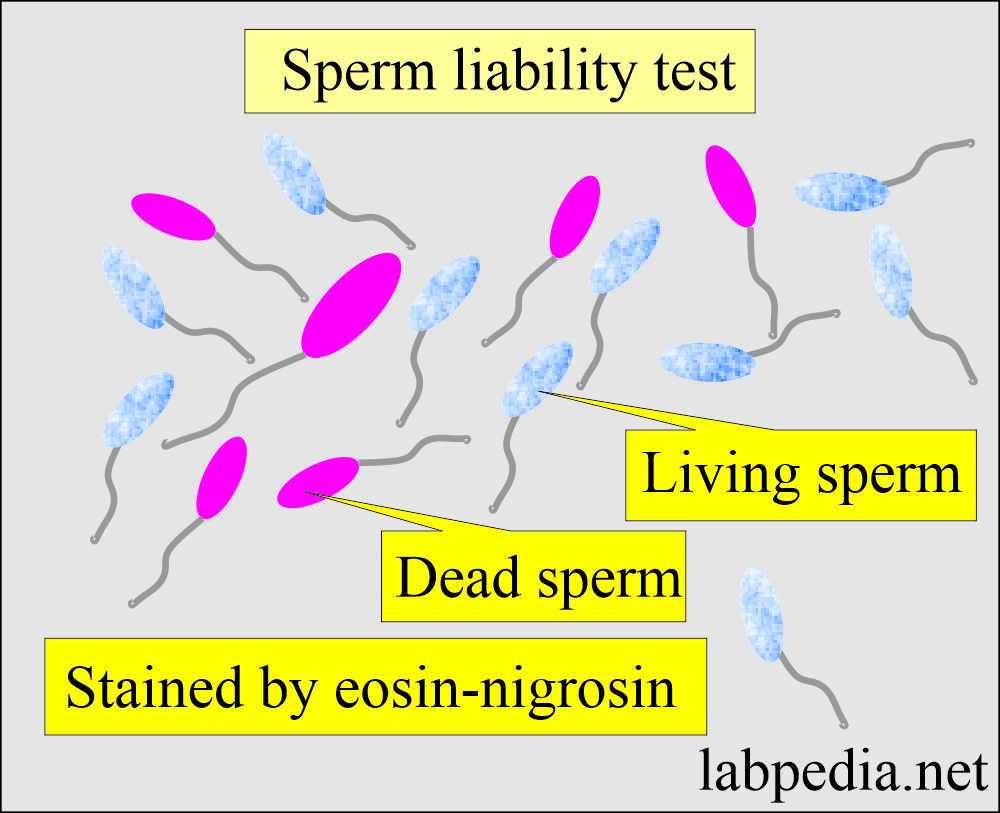 Sperm viability test (Eosine-nigrosine stain)