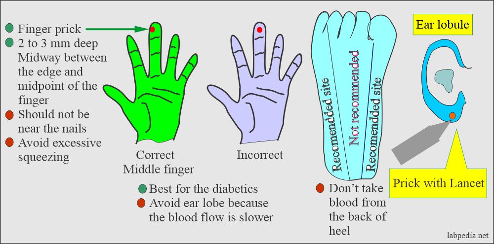 Capillary blood for diabetic patients