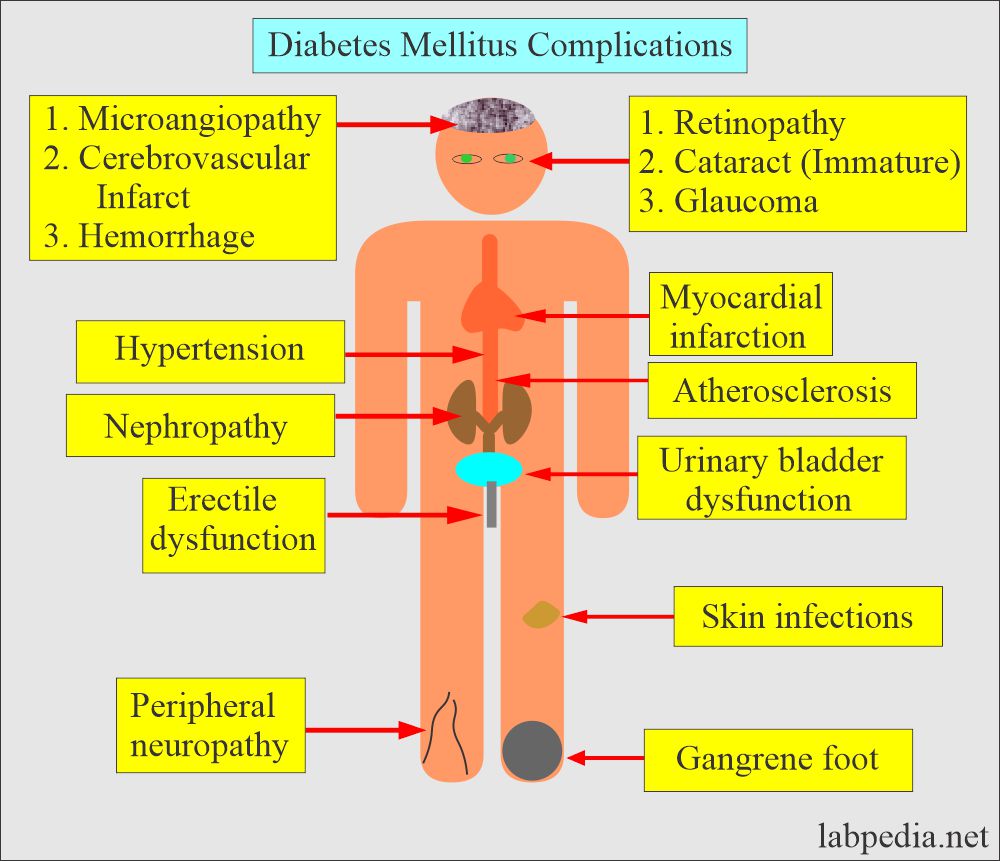 Difference Between Type 1 and Type 2 Diabetes Mellitus: Diabetes Mellitus complications 