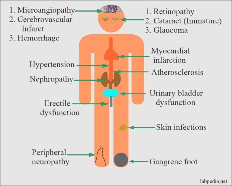 Difference Between Type 1 and Type 2 Diabetes Mellitus, and ...