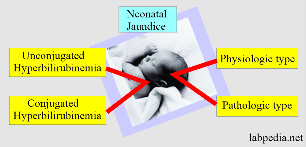 Neonatal jaundice classification