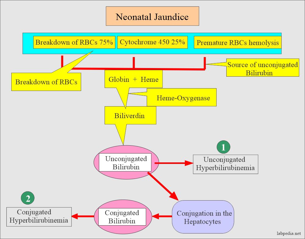 Differential Diagnosis Of Pathological Jaundice at Lois Ray blog